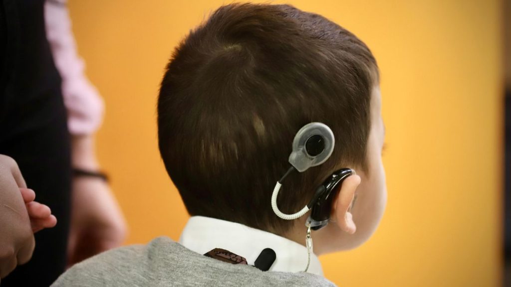 cCAMBIA VIDA IMPLANTE COCLEAR