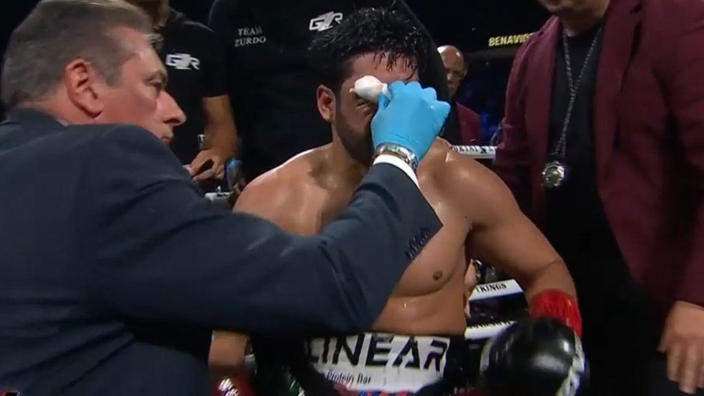 NOQUEA MONSTRUO A ZURDO